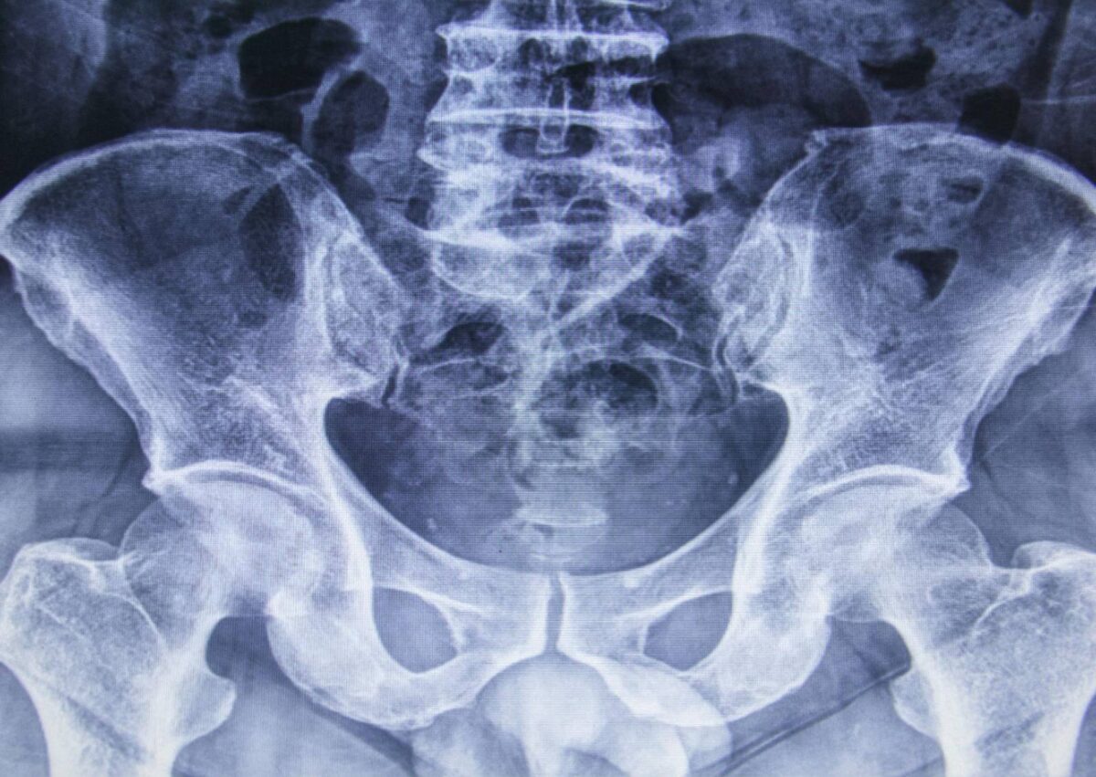Radiografia d'un home