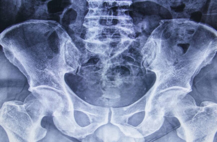 Radiografia d'un home