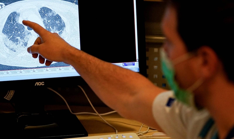 Un metge mostra en pantalla l'escaneig dels pulmons d'un pacient infectat per la COVID-19, a la unitat de "cura mitjana" per a pacients infectats per la COVID-19 a l'Hospital Erasme de Brussel·les, el 30 d'abril de 2020 durant un confinament al país per aturar la propagació del nou coronavirus. (Foto de Kenzo TRIBOUILLARD / AFP)
