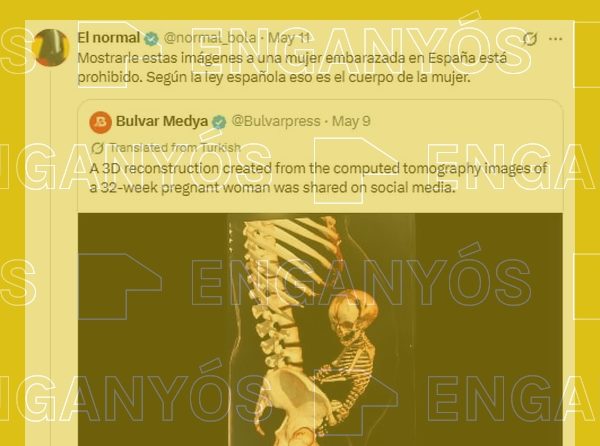 Missatge que afirma que ensenyar imatges d'un fetus a les embarassades està prohibit a Espanya, en contra d'avortar.
